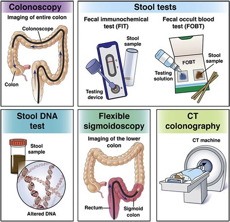 The Accuracy and Reliability of Fecal Occult Testing in Identifying Colorectal Cancer